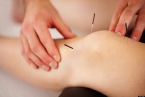 acupuncture, Littlehampton, Rustington, Climping, Bognor Regis, Felpham, Yapton, Arundel, Worthing, West Sussex, Natural Health, Physio, Healthcare, Osteopath, Chiropractor, Well-being, Counselling, Massage, Sports Massage, Relaxation, Pregnancy, Rehabilitation, Podiatry, Podiatrist, Chiropody