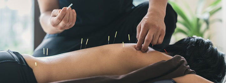 Acupuncture needling relax stress quit Littlehampton Chiro Rustington Arundel Goring Elmer Bognor West Sussex Sussex