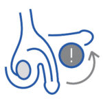 Erectile Dysfunction Treatment Littlehampton, EmSella, EmSella in Littlehampton, EmSella West Sussex, EmSella South Coat, Pelvic Floor, Dysfunction, Sexual, Pain, Dryness, Prostate, Pee, Urine, Leak, Laugh, Bladder, ED, Erectile Dysfunction, Magnets, Kegel, Kegels, Health, Tone, Muscle, Symptom, Strength, Electromagnetic, HIFEM, Weak, weakened, stimulation, contraction, treatment, non-surgical, high-intensity, focused, pelvic, tightness, men, women, exercise, vagina, vaginal, sensation, orgasm, post, partum, pregnancy, tear, active, female, male, reduced, laxity, patient, boost, aging, childbirth, surgery, pads, kegal, catheterisation, FDA, BTL, intimate, menopause, Sussex, West Sussex, Chichester, Portsmouth, Southampton, hove, Brighton, Hampshire, Hants, Surrey, Arundel, Midhurst, petersfield, Littlehampton, bognor, worthing, Oving, Wittering, Emsworth, Hayling, Horsham, Waterlooville, Havant, Fareham, Westbourne, Lavant, Boxgrove, Petworth