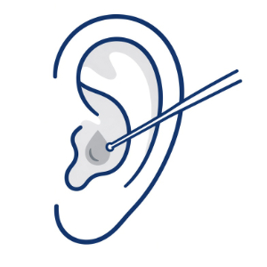 Ear Wax Removal